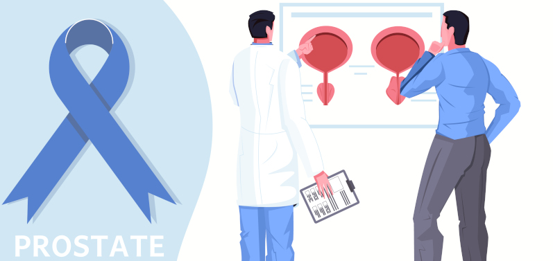 Prostatectomy